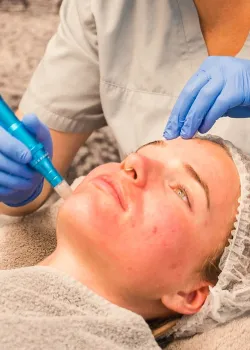 Micro Needling Hamburg | Privatpraxis Dr. Anna Brandenburg